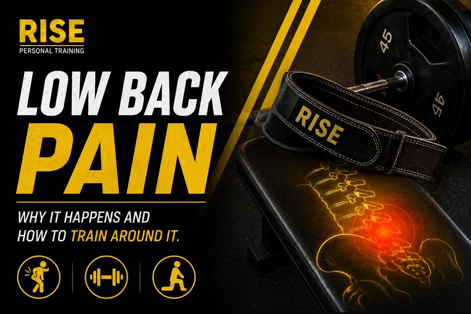 Low Back Pain: Why It Happens and How to Train Around It
