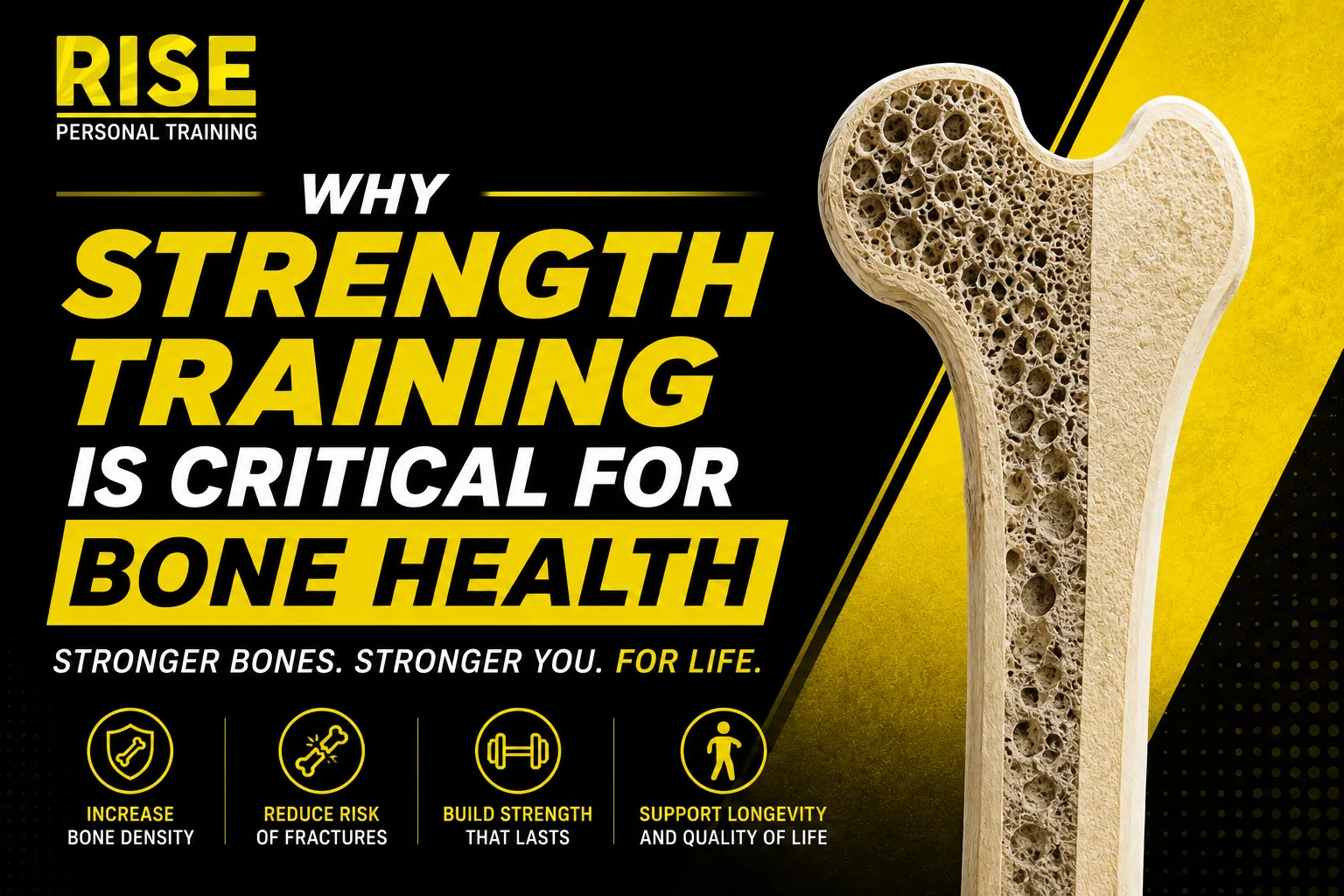 Why Strength Training is Critical for Bone Health